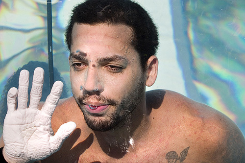 David Blaine and his nasty prune hand